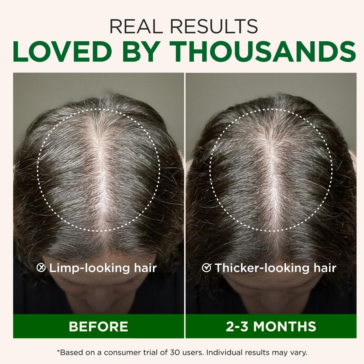 100% Pure Rosemary Essential Oil – 4 Fl Oz – Rosemary Oil for Hair, Skin, Dif…